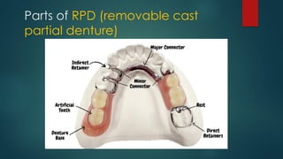 INTRODUCTION TO Removable Partial Denture - Dr Sanket Jadhav | PPTX