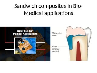 Sandwich composites in Bio-
Medical applications
 