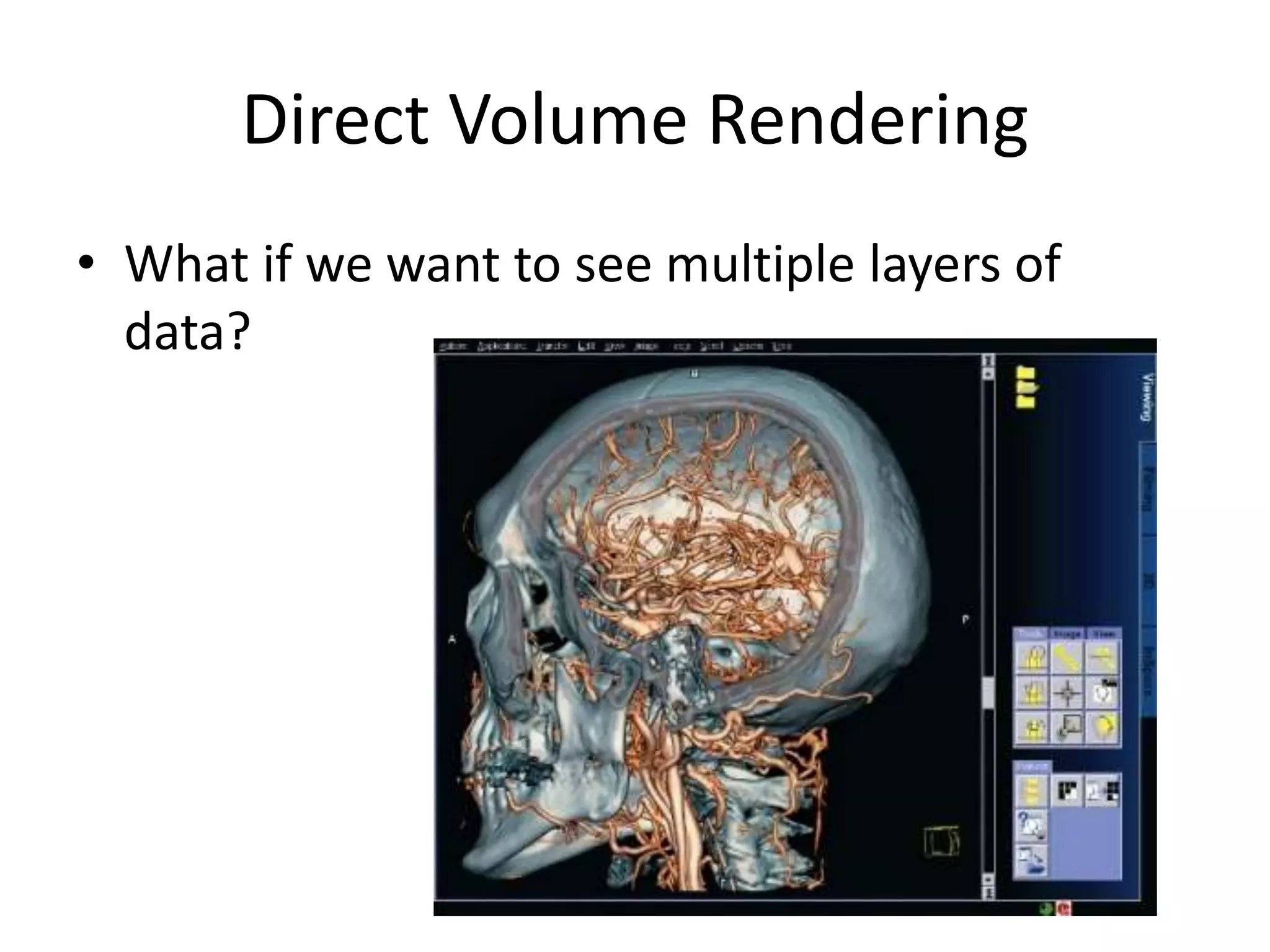 Direct Volume RenderingWhat if we want to see multiple layers of data?