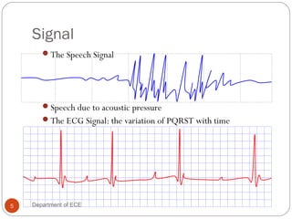 Signal
The Speech Signal
Speech due to acoustic pressure
The ECG Signal: the variation of PQRST with time
5 Department of ECE
 