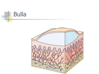 Introduction to skin and various skin conditions. | PPT