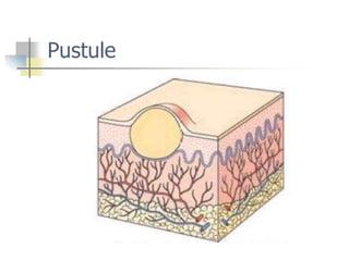 Introduction to skin and various skin conditions. | PPT