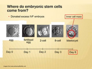 8-cell blastocystfertilised
egg
2-cellegg
Day 0 Day 1 Day 2 Day 3 Day 6
• Donated excess IVF embryos
Images from www.advancedfertility.com
Where do embryonic stem cells
come from?
Inner cell mass
 