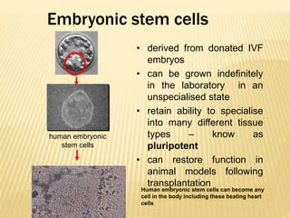 Embryonic stem cells
• derived from donated IVF
embryos
• can be grown indefinitely
in the laboratory in an
unspecialised state
• retain ability to specialise
into many different tissue
types – know as
pluripotent
• can restore function in
animal models following
transplantation
Human embryonic stem cells can become any
cell in the body including these beating heart
cells
human embryonic
stem cells
 