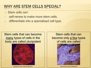 WHY ARE STEM CELLS SPECIAL?
 Stem cells can:
1. self-renew to make more stem cells.
2. differentiate into a specialised cell type.
Embryonic stem cells (pluripotent)
Stem cells that can become
many types of cells in the
body are called pluripotent
Tissue stem cells (multipotent)
Stem cells that can
become only a few types
of cells are called
multipotent
 