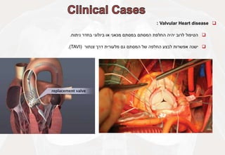 
Valvular Heart disease
:

‫הטיפול‬
‫לרוב‬
‫יהיה‬
‫החלפת‬
‫המסתם‬
‫במסתם‬
‫מכאני‬
‫או‬
‫ביולוגי‬
‫בחדר‬
‫ניתוח‬
.

‫ישנה‬
‫אפשרות‬
‫לבצע‬
‫החלפה‬
‫של‬
‫המסתם‬
‫גם‬
‫מלעורית‬
‫דרך‬
‫צנתור‬
(
TAVI
)
.
 