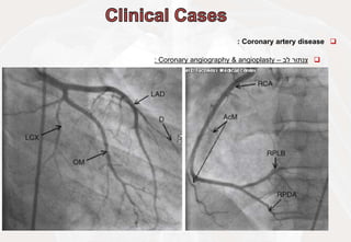 
Coronary artery disease
:

‫צנתור‬
‫לב‬
–
Coronary angiography & angioplasty
:
 