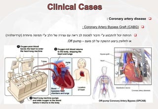 
Coronary artery disease
:

Coronary Artery Bypass Graft (CABG)
:

‫הניתוח‬
‫יכול‬
‫להתבצע‬
‫ע‬
"
‫י‬
‫חיבור‬
‫למכונת‬
‫לב‬
‫ריאה‬
‫עם‬
‫עצירה‬
‫של‬
‫הלב‬
‫ע‬
"
‫י‬
‫תמיסה‬
‫מיוחדת‬
(
‫קרדיופלגיה‬
)
‫או‬
‫לחלופין‬
‫ביצוע‬
‫ההשקה‬
‫על‬
‫לב‬
‫פועם‬
–
Off pump
.
 