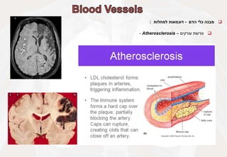 
‫מבנה‬
‫כלי‬
‫הדם‬
-
‫דוגמאות‬
‫למחלות‬
:

‫טרשת‬
‫עורקים‬
–
Atherosclerosis
-
 