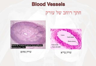 ‫עורק‬ ‫של‬ ‫רוחב‬ ‫חתך‬
‫בריא‬ ‫עורק‬
‫סתום‬ ‫עורק‬
 