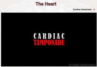 
Cardiac tamponade
 