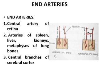 END ARTERIES
• END ARTERIES:
1.Central artery of
retina
2. Arteries of spleen,
liver, kidneys,
metaphyses of long
bones
3. Central branches of
cerebral cortex
 