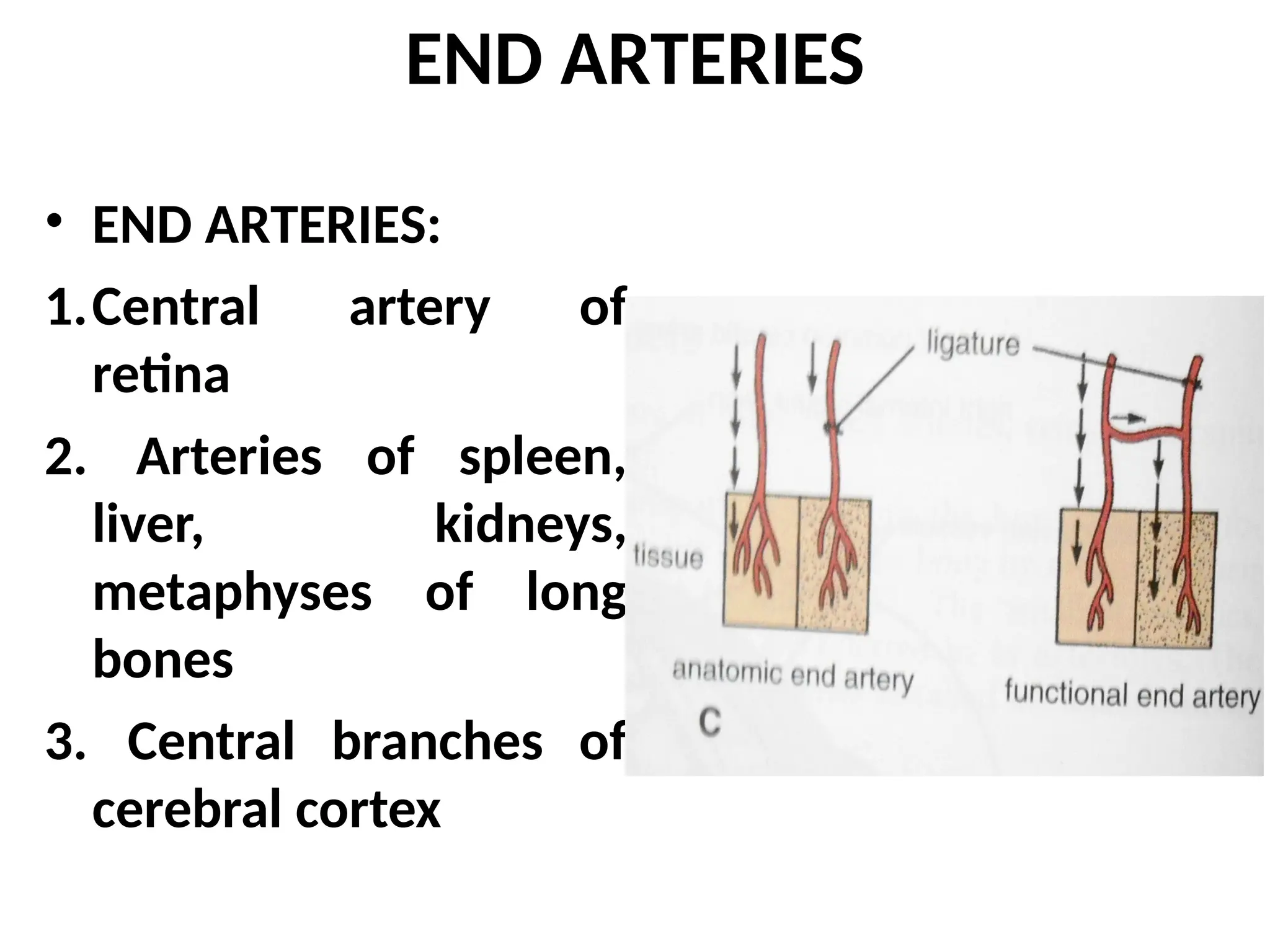 END ARTERIES
• END ARTERIES:
1.Central artery of
retina
2. Arteries of spleen,
liver, kidneys,
metaphyses of long
bones
3. Central branches of
cerebral cortex
 