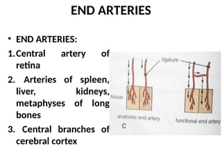 END ARTERIES
• END ARTERIES:
1.Central artery of
retina
2. Arteries of spleen,
liver, kidneys,
metaphyses of long
bones
3. Central branches of
cerebral cortex
 