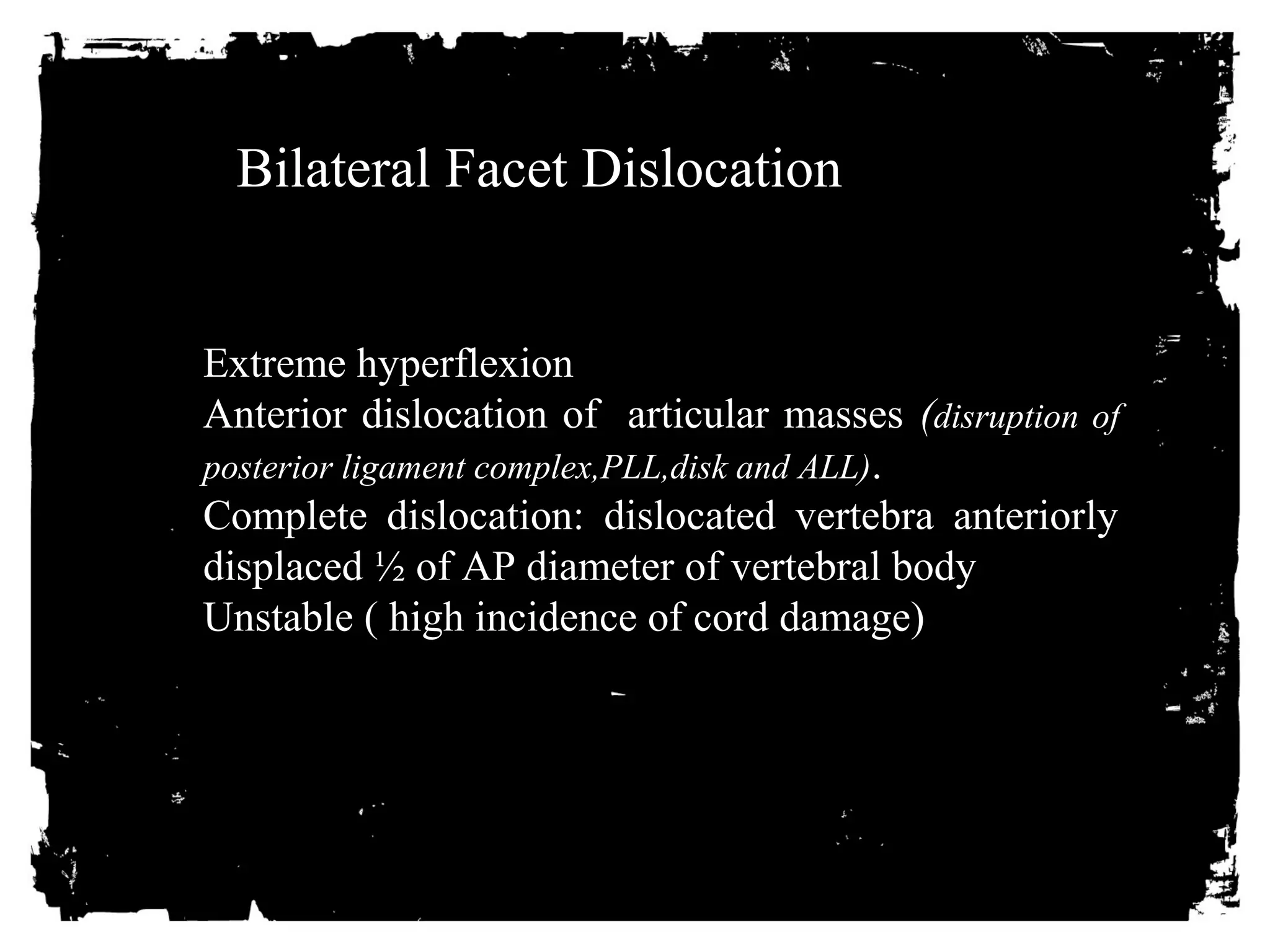 Bilateral Facet Dislocation 
Extreme hyperflexion 
Anterior dislocation of articular masses (disruption of 
posterior ligament complex,PLL,disk and ALL). 
Complete dislocation: dislocated vertebra anteriorly 
displaced ½ of AP diameter of vertebral body 
Unstable ( high incidence of cord damage) 
 