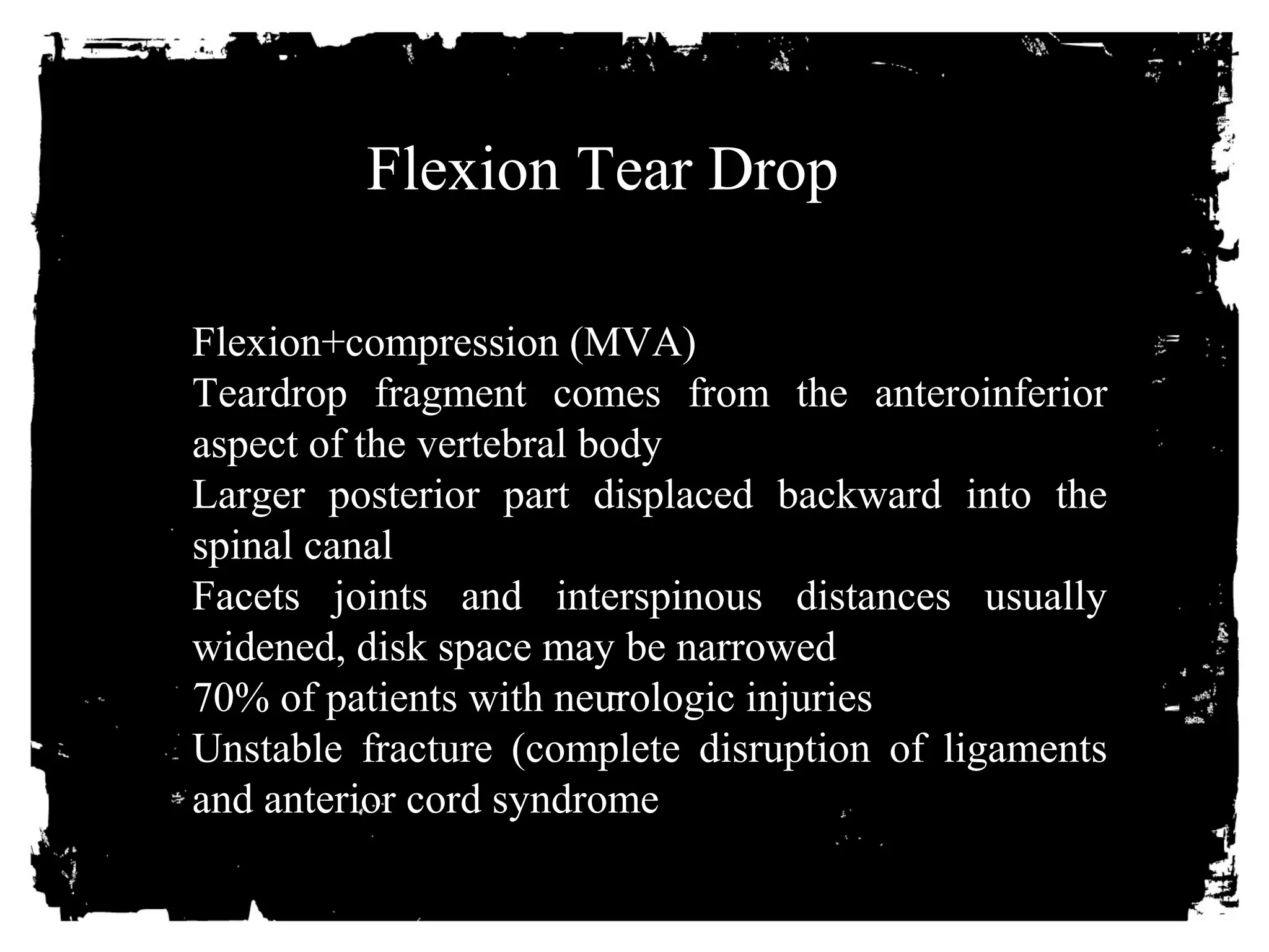 Flexion Tear Drop 
Flexion+compression (MVA) 
Teardrop fragment comes from the anteroinferior 
aspect of the vertebral body 
Larger posterior part displaced backward into the 
spinal canal 
Facets joints and interspinous distances usually 
widened, disk space may be narrowed 
70% of patients with neurologic injuries 
Unstable fracture (complete disruption of ligaments 
and anterior cord syndrome 
 