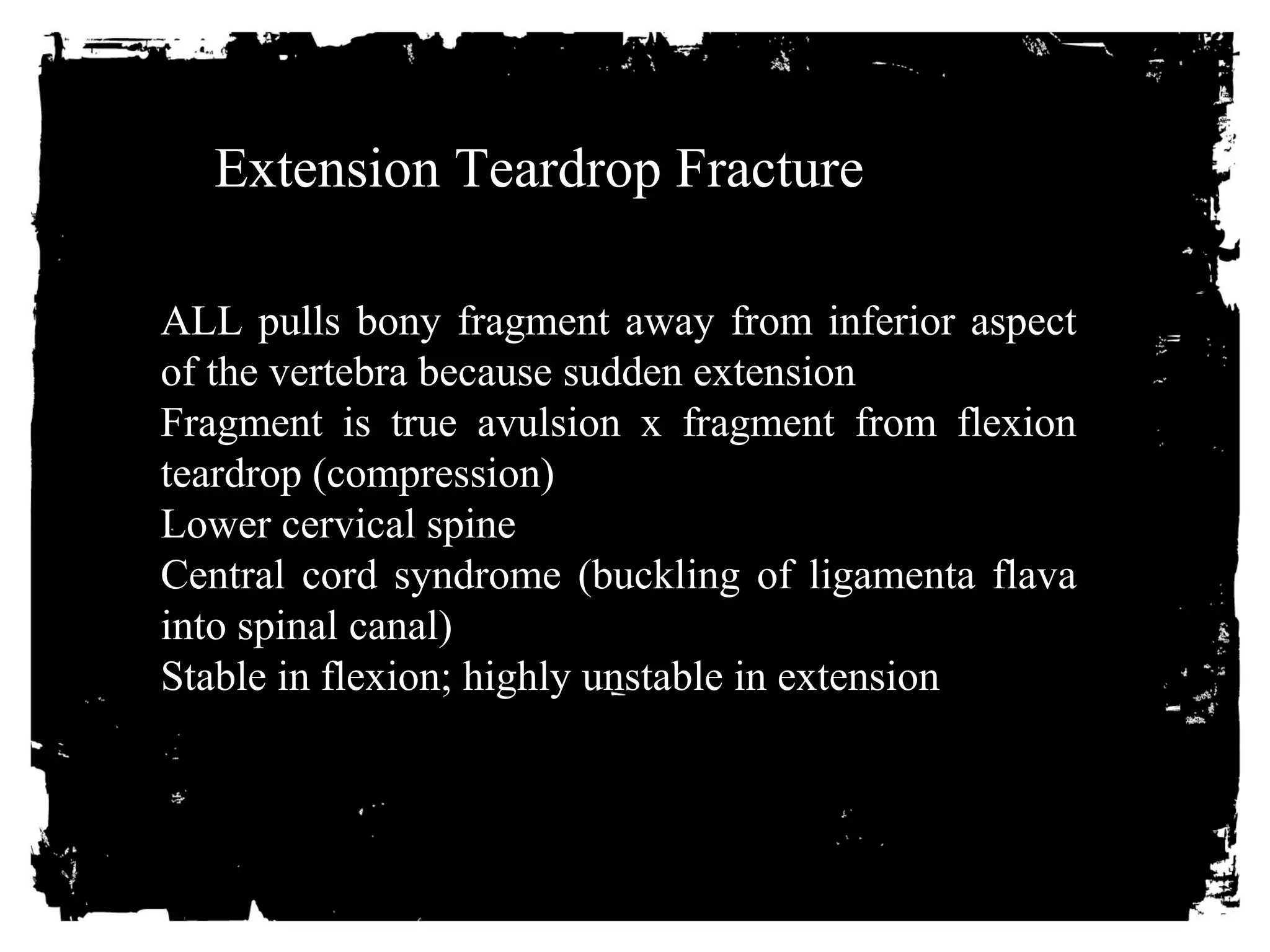 Extension Teardrop Fracture 
ALL pulls bony fragment away from inferior aspect 
of the vertebra because sudden extension 
Fragment is true avulsion x fragment from flexion 
teardrop (compression) 
Lower cervical spine 
Central cord syndrome (buckling of ligamenta flava 
into spinal canal) 
Stable in flexion; highly unstable in extension 
 