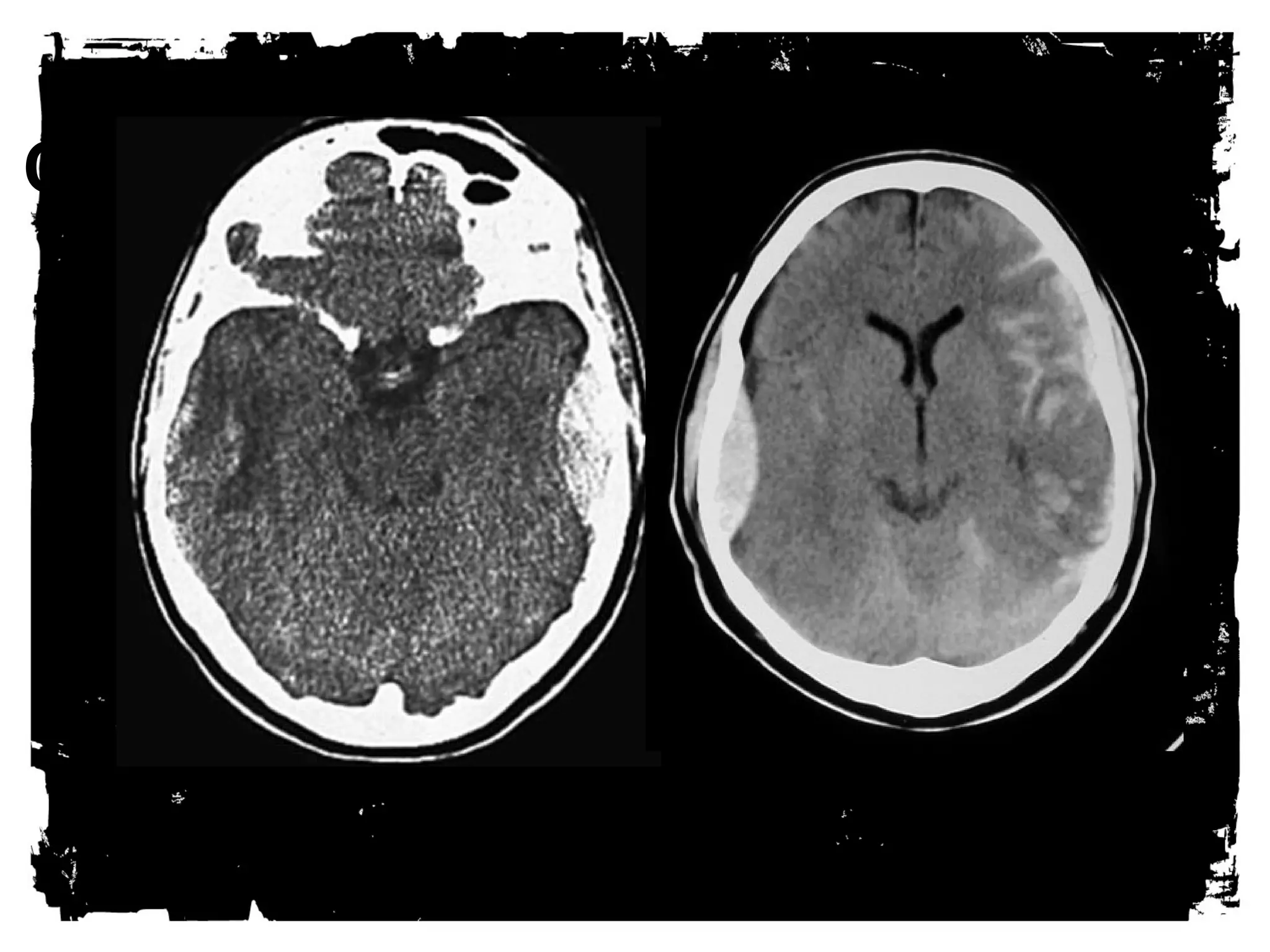 CLICK HERE TO ADD TEXT 
 