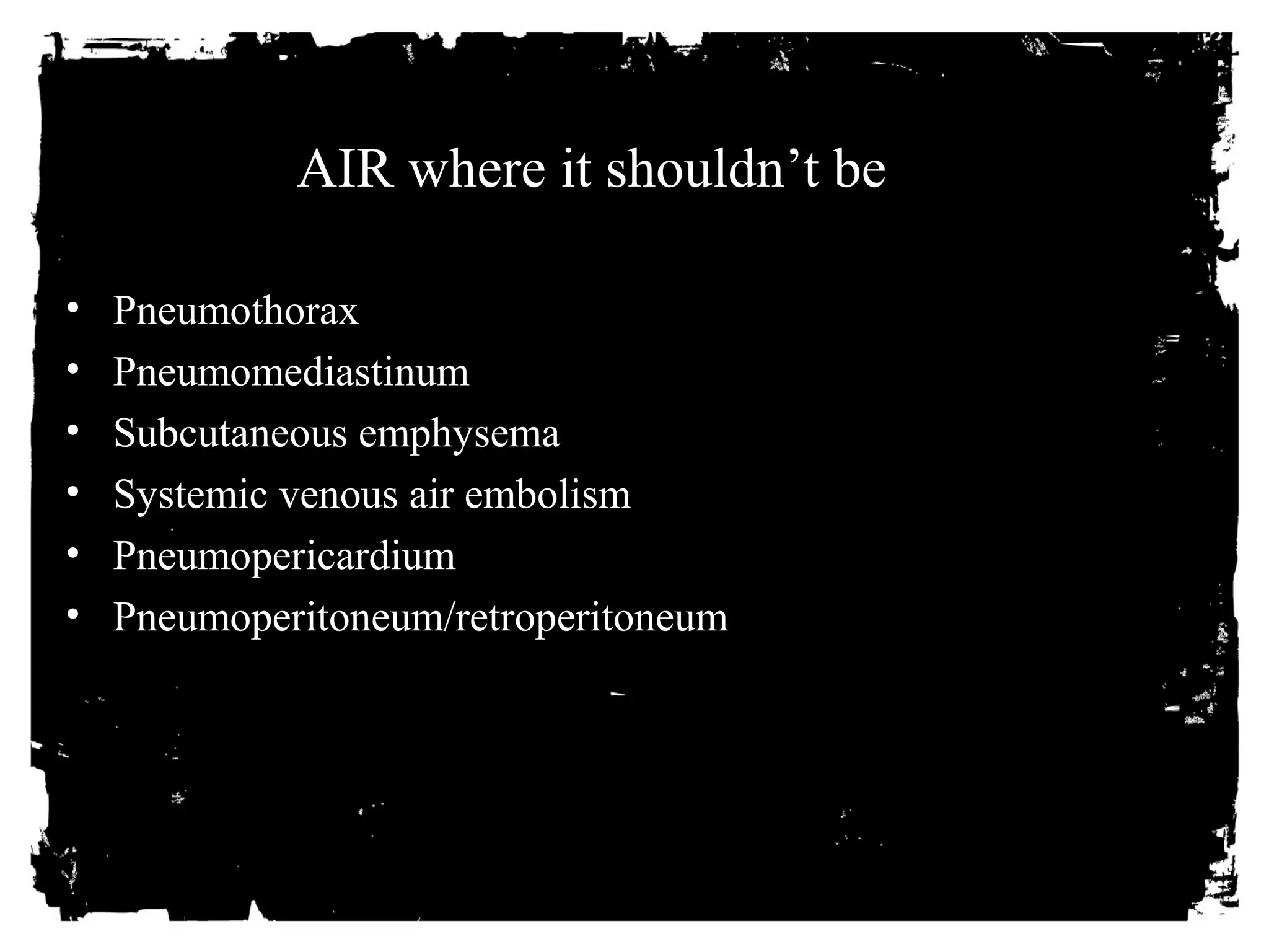 AIR where it shouldn’t be 
• Pneumothorax 
• Pneumomediastinum 
• Subcutaneous emphysema 
• Systemic venous air embolism 
• Pneumopericardium 
• Pneumoperitoneum/retroperitoneum 
 