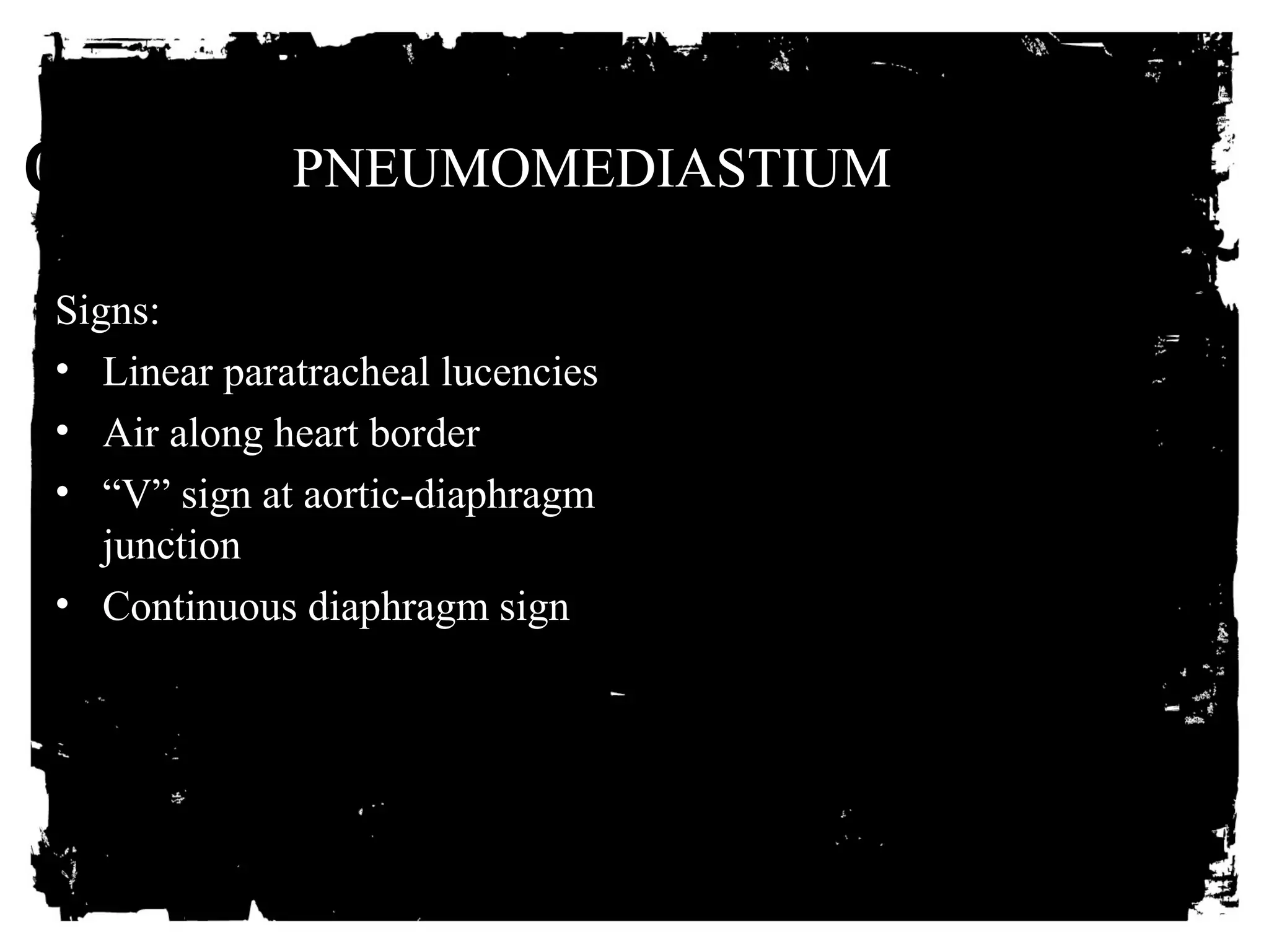 CLICK HERE PNEUMOMEDIASTIUM 
TO ADD TEXT 
Signs: 
• Linear paratracheal lucencies 
• Air along heart border 
• “V” sign at aortic-diaphragm 
junction 
• Continuous diaphragm sign 
 
