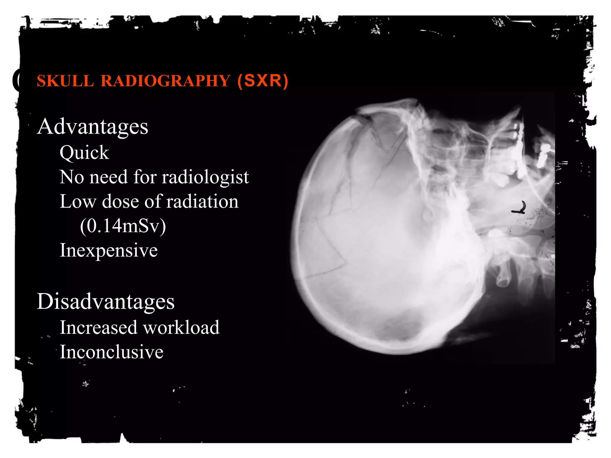CLICK SKULL RA DHIOGERARPHEY ( STXRO) ADD TEXT 
Advantages 
Quick 
No need for radiologist 
Low dose of radiation 
(0.14mSv) 
Inexpensive 
Disadvantages 
Increased workload 
Inconclusive 
 