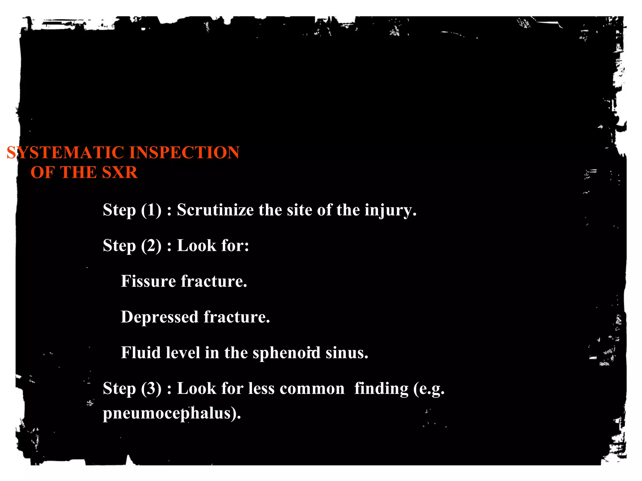 SYSTEMATIC INSPECTION 
OF THE SXR 
Step (1) : Scrutinize the site of the injury. 
Step (2) : Look for: 
Fissure fracture. 
Depressed fracture. 
Fluid level in the sphenoid sinus. 
Step (3) : Look for less common finding (e.g. 
pneumocephalus). 
 