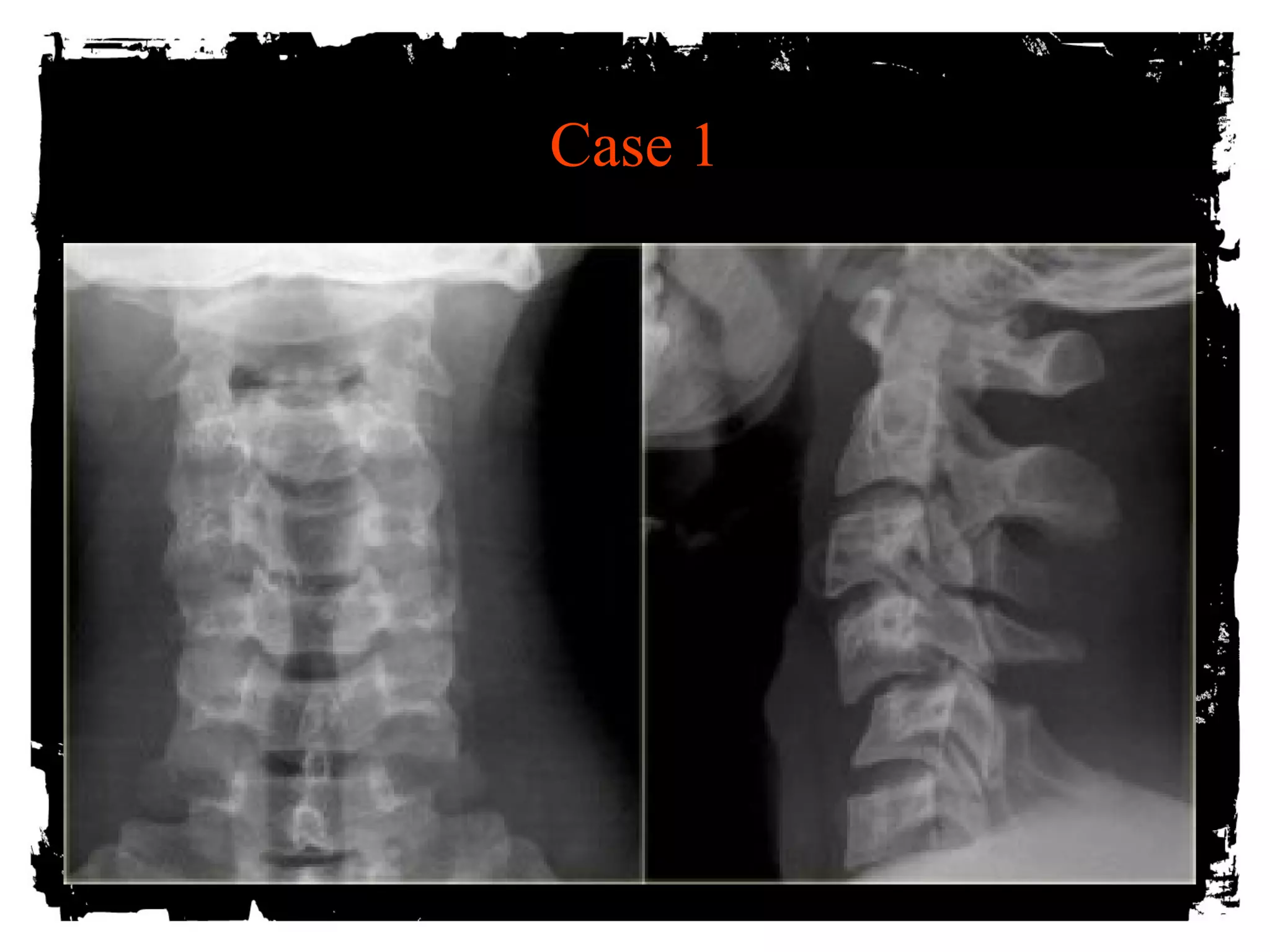 Case 1 
 