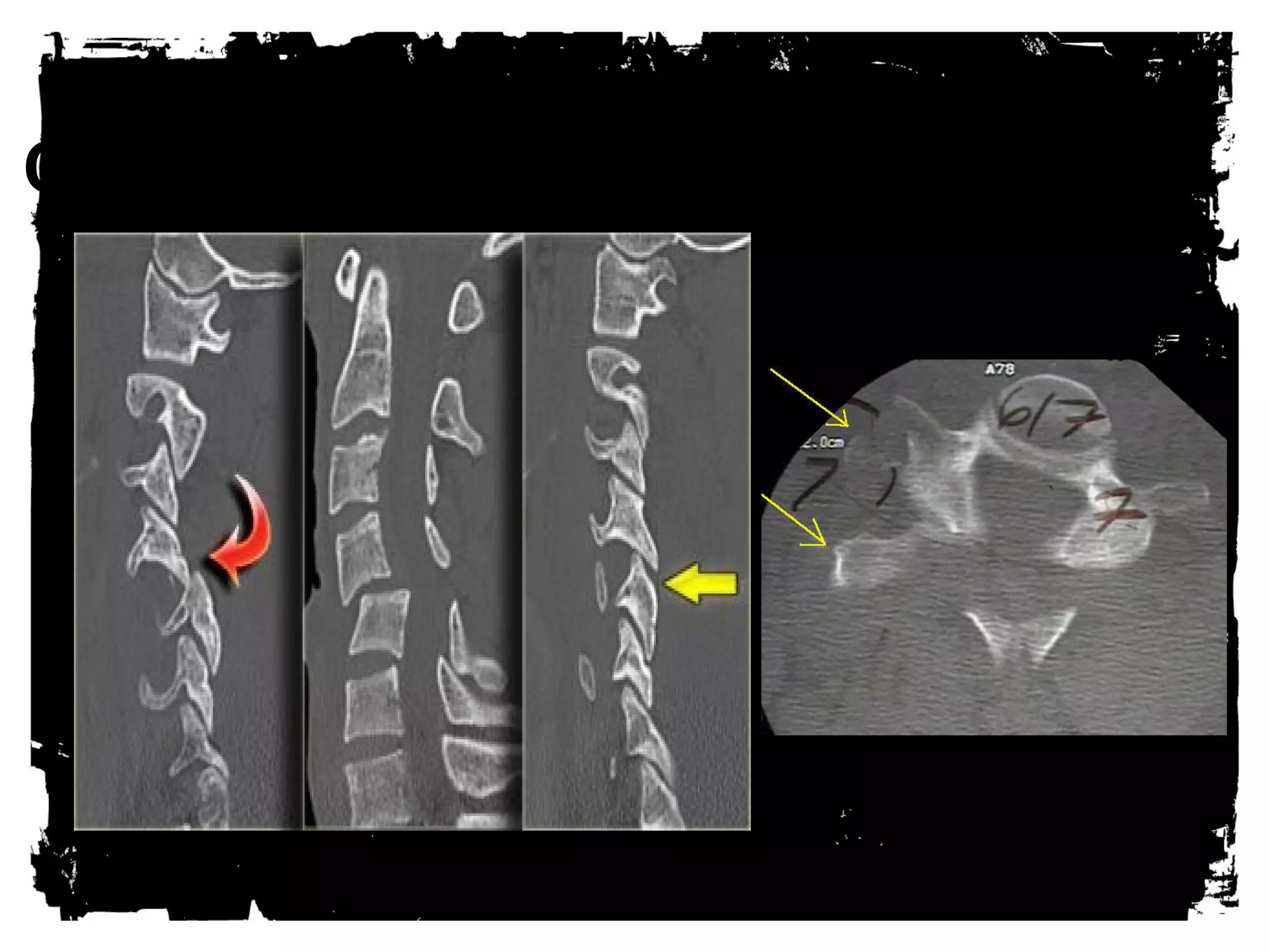 CLICK HERE TO ADD TEXT 
 