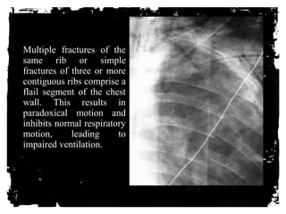 Introduction to trauma imaging. Guidelines and highlights for different ...