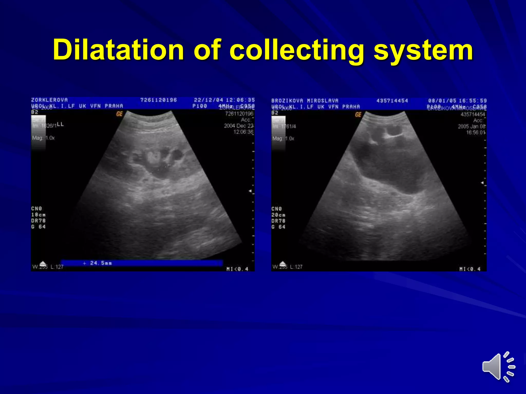Introduction to urology by sayed eleweedy | PPT