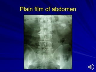 Plain film of abdomen
 
