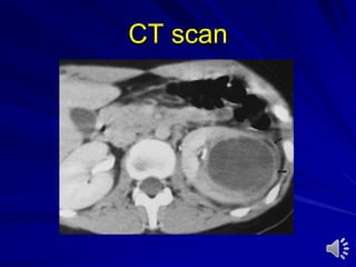 CT scan
 