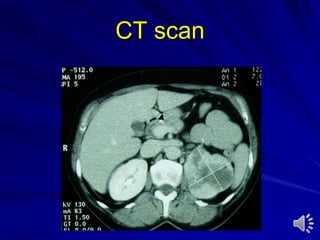 CT scan
 