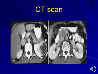 CT scan
 