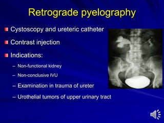 Retrograde pyelography
Cystoscopy and ureteric catheter
Contrast injection
Indications:
– Non-functional kidney
– Non-conclusive IVU
– Examination in trauma of ureter
– Urothelial tumors of upper urinary tract
 