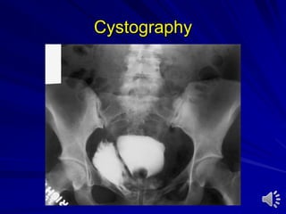 Cystography
 