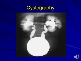Cystography
 