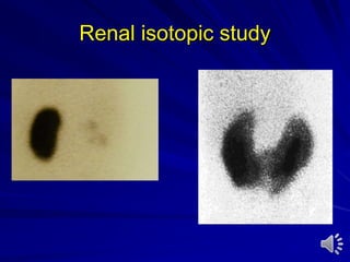 Renal isotopic study
 
