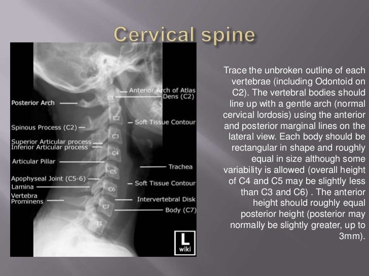 Introduction to musculoskeletal radiology