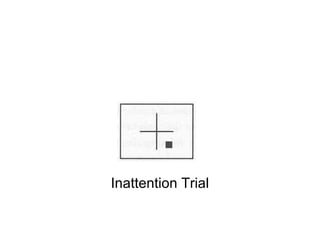 Inattention Trial
 