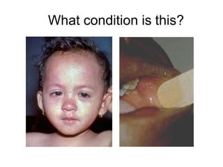 What condition is this?
 