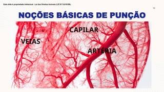 NOÇÕES BÁSICAS DE PUNÇÃO
10
Este slide é propriedade intelectual - Lei dos Direitos Autorais (LEI Nº 9.610/98).
ARTÉRIA
VEIAS
CAPILAR
 