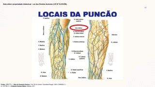 LOCAIS DA PUNÇÃO
11
Este slide é propriedade intelectual - Lei dos Direitos Autorais (LEI Nº 9.610/98).
 