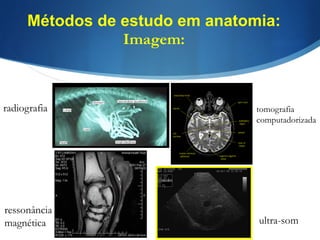 Métodos de estudo em anatomia:
Imagem:
radiografia tomografia
computadorizada
ressonância
magnética ultra-som
 