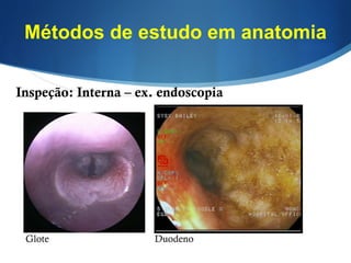 Métodos de estudo em anatomia
Inspeção: Interna – ex. endoscopia
Glote Duodeno
 