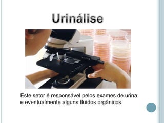 Este setor é responsável pelos exames de urina
e eventualmente alguns fluídos orgânicos.
 