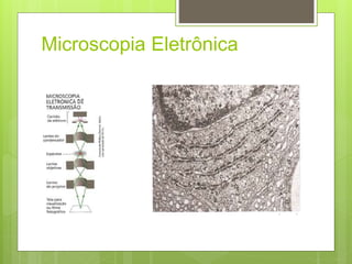 Microscopia Eletrônica
 