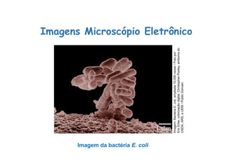 Imagens Microscópio Eletrônico
Imagem da bactéria E. coli
Ciências, 8º Série
Características gerais da célula e suas estruturas
Imagem:
Bactéria
E.
coli,
ampliada
10.000
vezes
/
Foto
por
Eric
Erbe,
colorização
digital,
Christopher
Pooley,
amboms
do
USDA,
ARS,
a
UEM
/
Public
Domain.
 