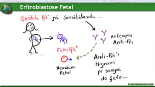 Eritroblastose Fetal
 
