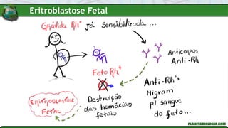 Eritroblastose Fetal
 